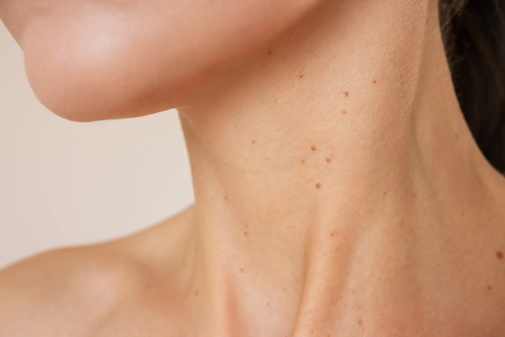 Spot Away | Schoonheidssalon Astrid Vervoort