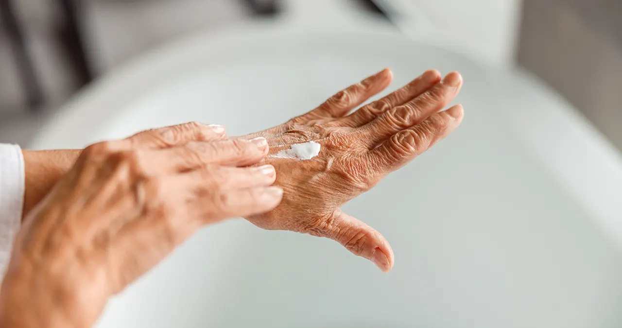 Ouderdomsjeuk: wat is het en wat kun je eraan doen? Schoonheidssalon Astrid Vervoort