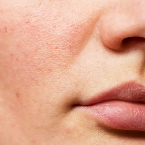 Nouvital Skin Calming Cream | Schoonheidssalon Astrid Vervoort