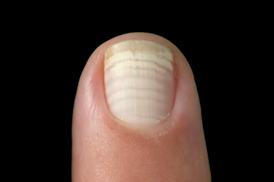 Witte horizontale lijnen op de nagels | Schoonheidssalon Astrid Vervoort